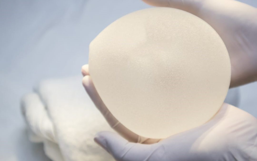 Breast Implant – associated large cell lymphoma (BIA-ALCL)