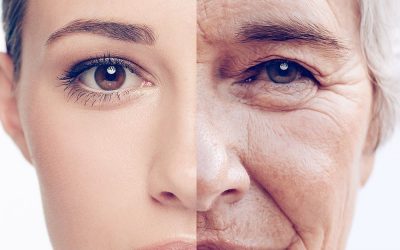 Can wrinkles be a driver of aging?