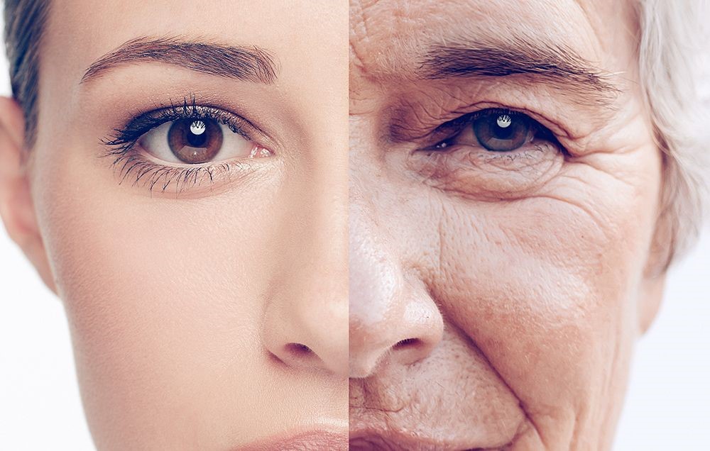 Can wrinkles be a driver of aging?