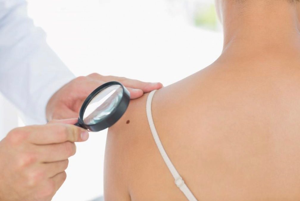 How often should I have a skin cancer check