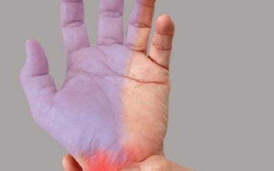 Understanding Carpal Tunnel Syndrome: symptoms, causes and treatment