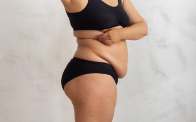 Loose skin after Wegovy – prevention and treatment options