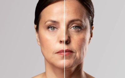 Understanding “Ozempic Face”