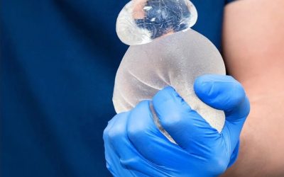 Ruptured breast implant