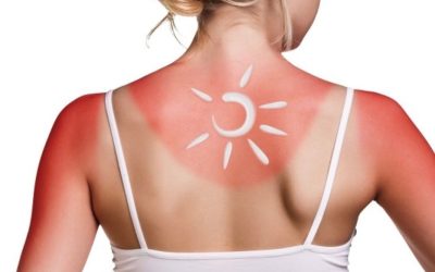 Sun Myths, Busted: Base Tans, Window UV, and Why It’s Never Too Late to Protect Your Skin